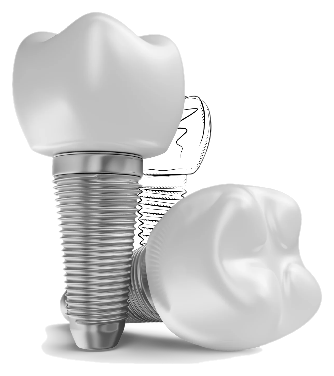 Implante dentário com coroa